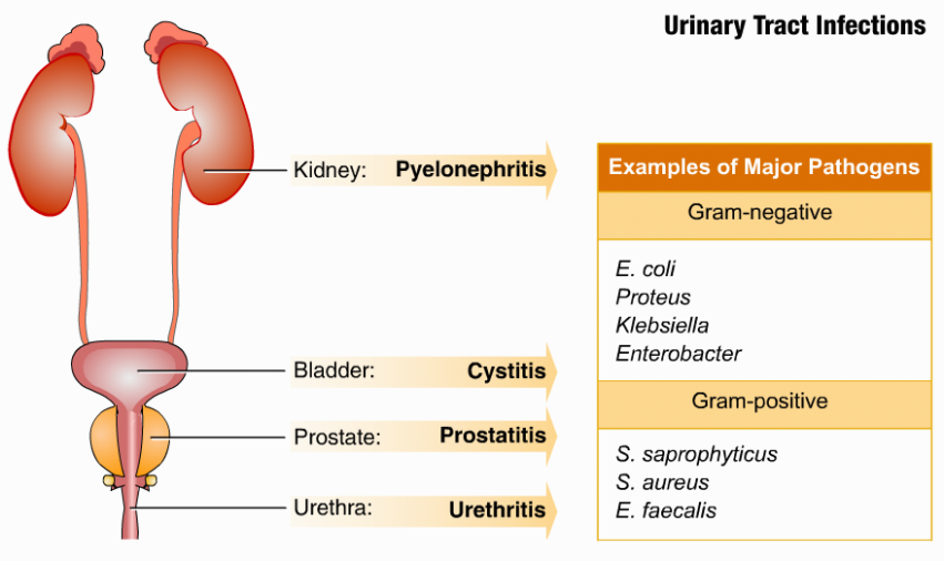 1517662836 Urinary Tract Infections Zero Infections.png